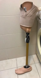 Modular Hip Prosthesis for Congenital Underdevelopment PN6-72