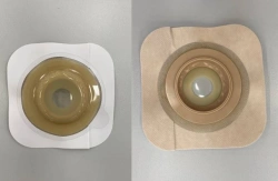 Rehabilitation Device for Stoma Use: Flat and Convex Plates