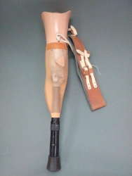 Non-Modular Hip Prosthesis for Congenital Deficiency