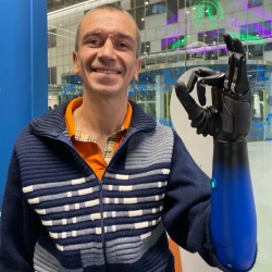 Microprocessor-Controlled Forearm Prosthesis PR2 MANIFESTO-H