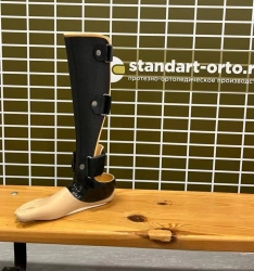 Customizable Foot Prosthesis for Partial Foot Amputation
