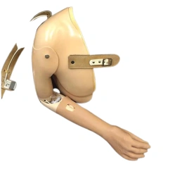 Upper Limb Prosthetics