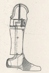 Shopar (Lisfranc) Foot Prosthesis PН0-06-02