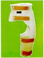 Hip Joint Orthosis for Stabilization