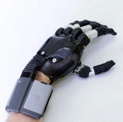 Microprocessor-Controlled Hand Prosthesis for Partial Hand Amputation